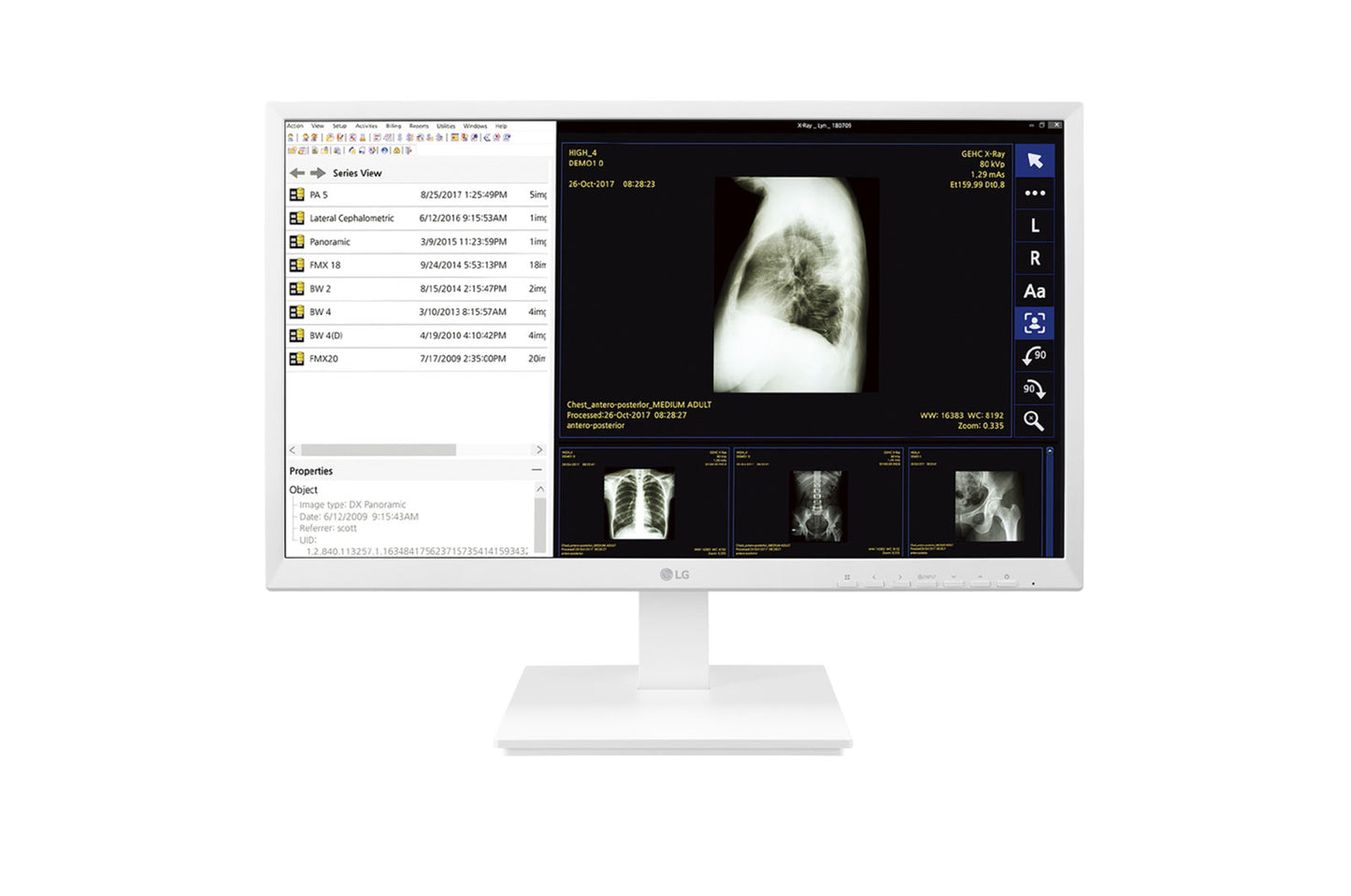 LG 24CK560N-3A All-in-One PC/workstation AMD G 23.8" 1920 x 1080 pixels 4 GB DDR4-SDRAM 32 GB SSD Wi-Fi 4 (802.11n) White