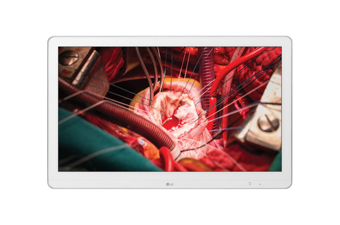 27IN LG MEDICAL IPS 4K SURGICAL MONITOR, 1920 X 1080, DVI-D 3G-SDI HDMI, WHITE,